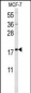 SUMO1 Antibody